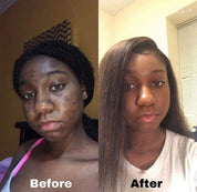 Dark Spot Fader Cream